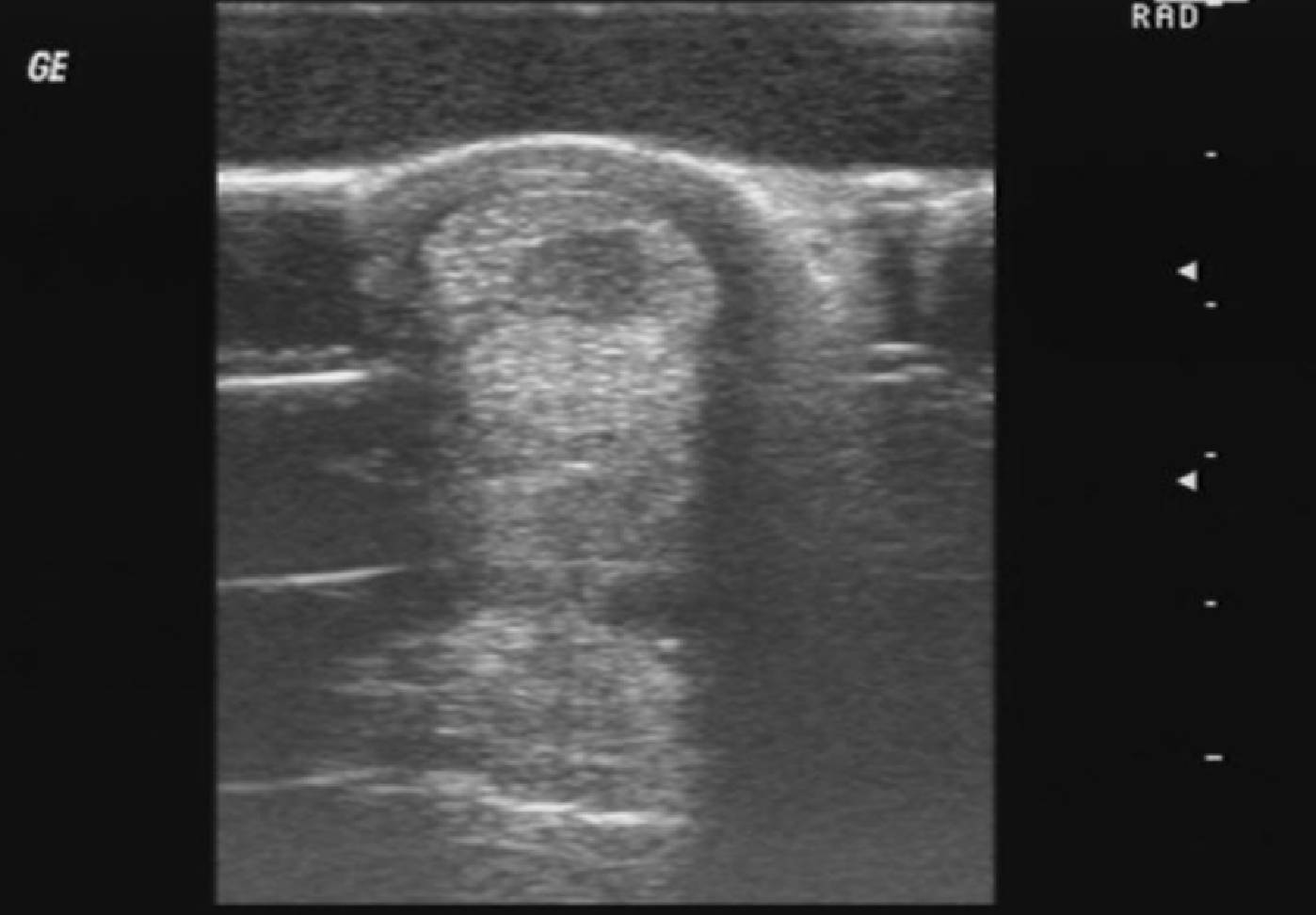 Ultraschallbild Sehnenschaden Pferd