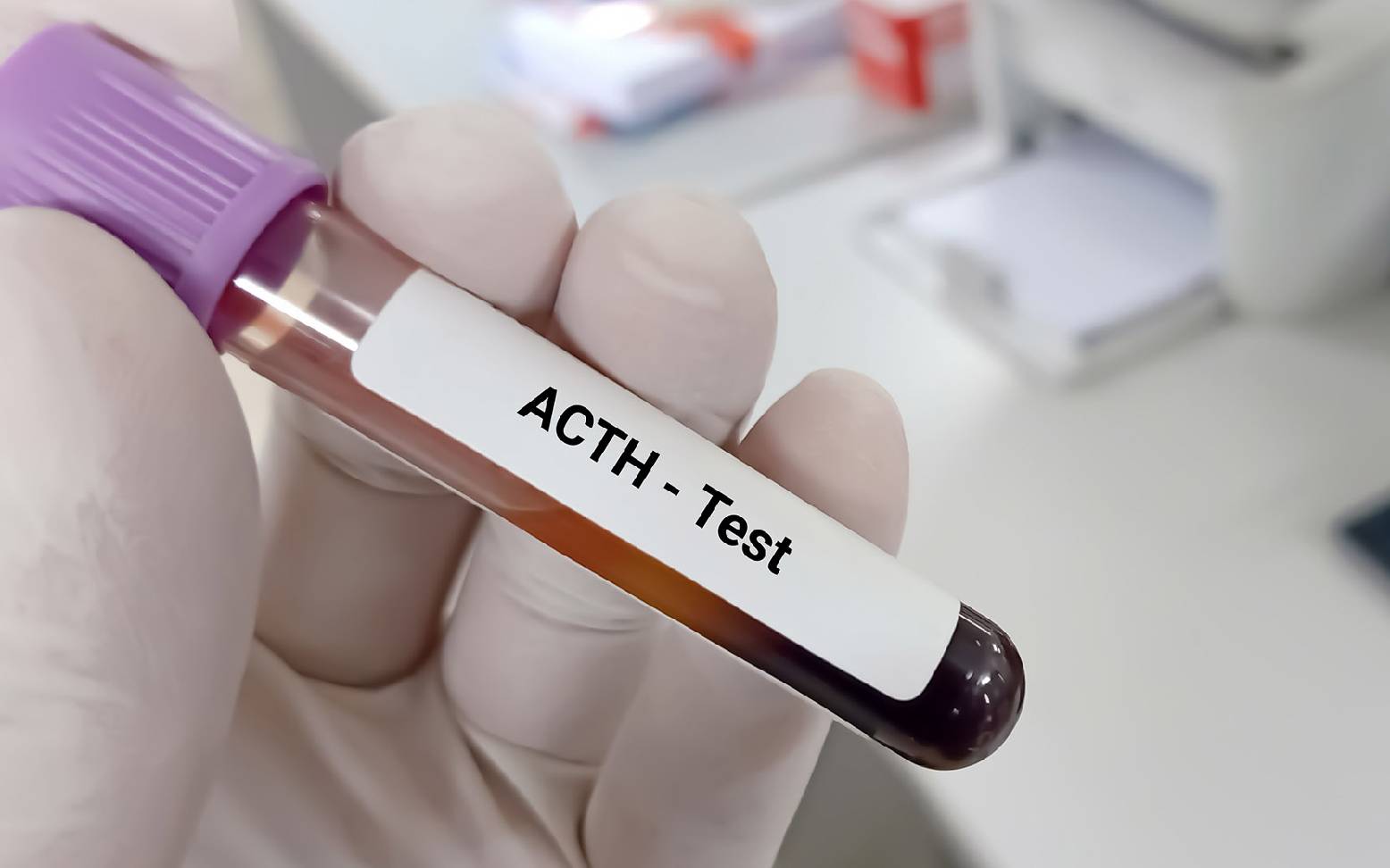 ACTH test