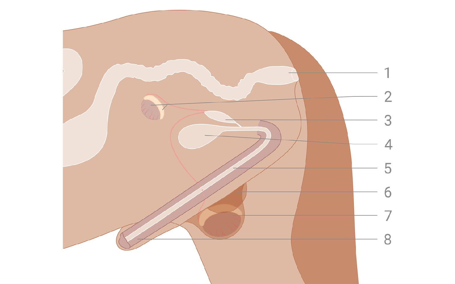 Diagram of abdominal cryptorchidism