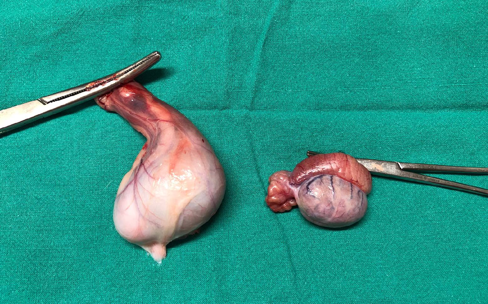 Testicles after castration