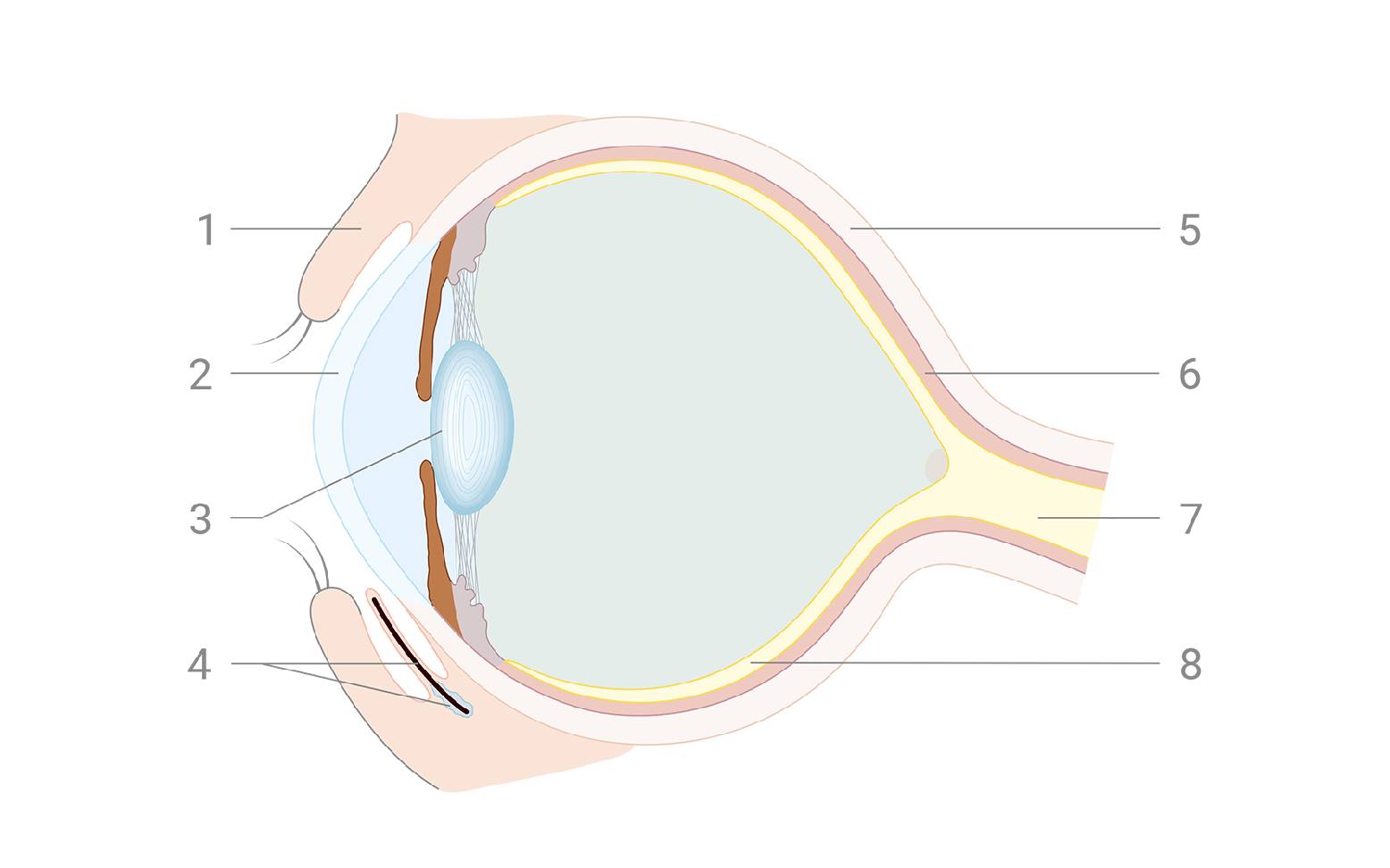 Schema Auge Katarakt
