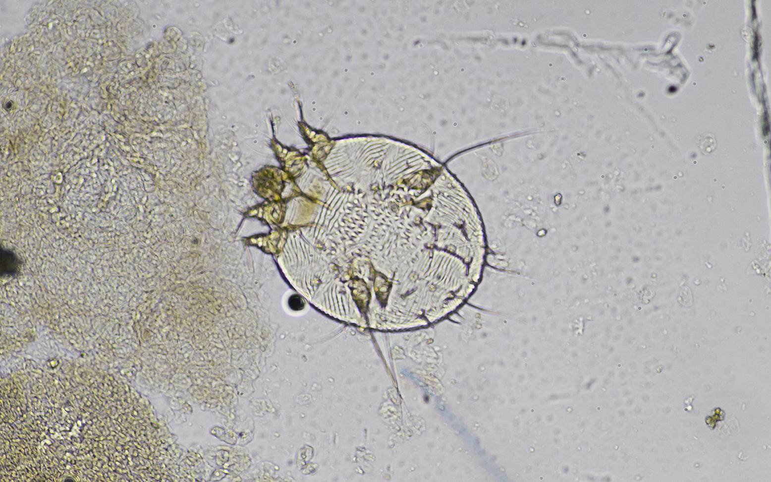 Sarcoptes mite 