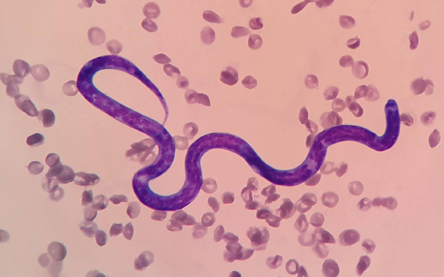 Dirofilaria larva in blood smear