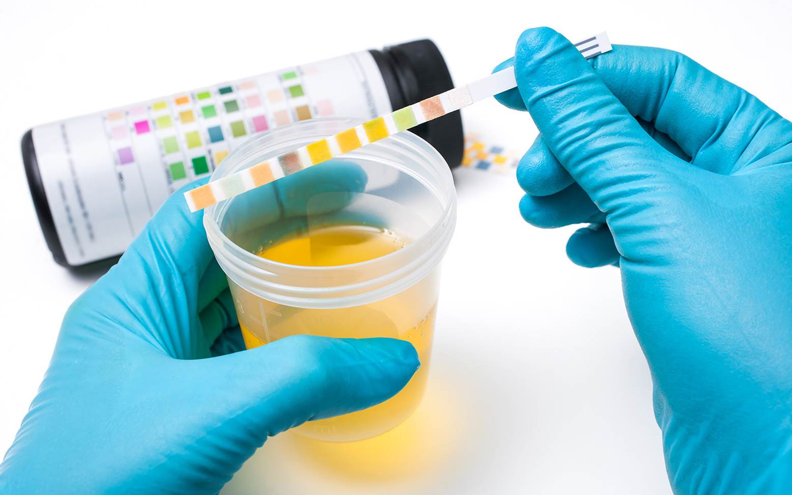 Urine stick test