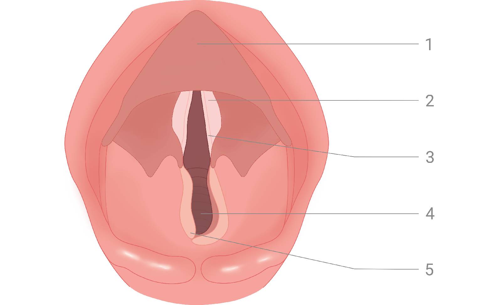 Diagram of the horse's larynx Pathological