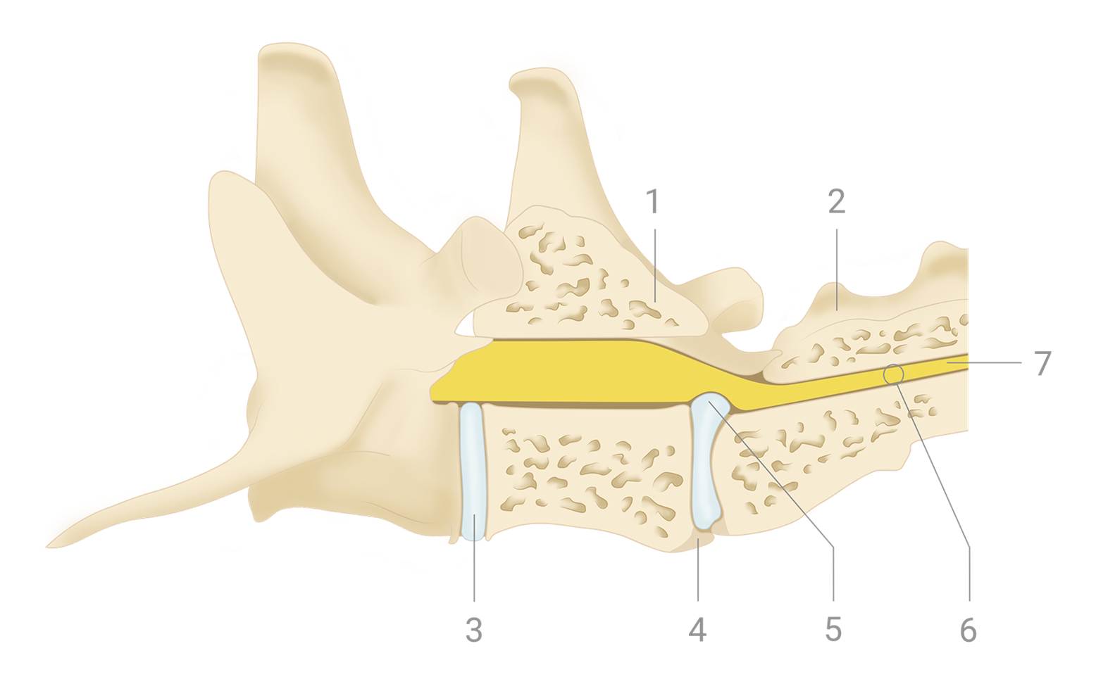 Schematic diagram of cauda equina syndrome in dogs