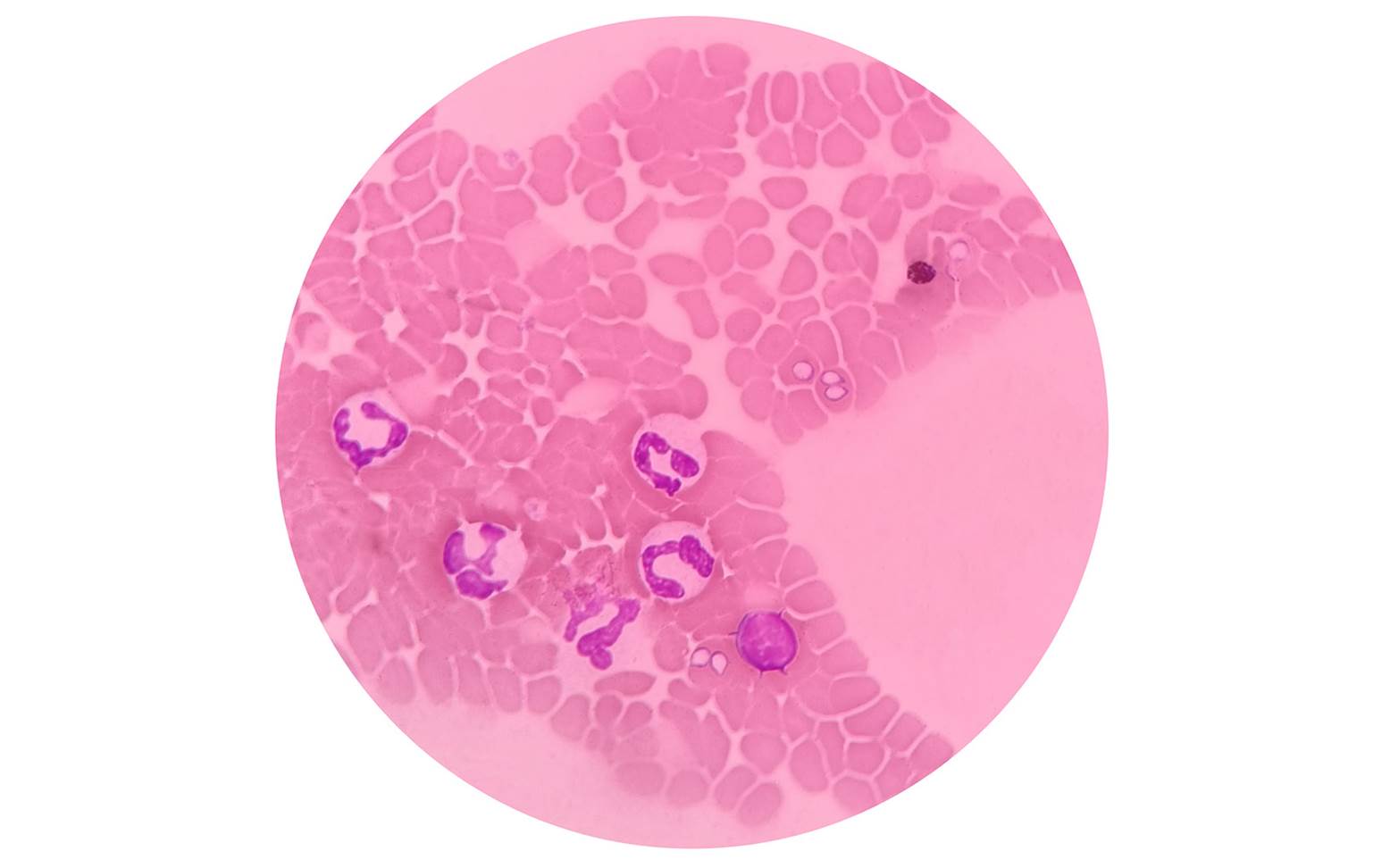 Babesia in blood smear