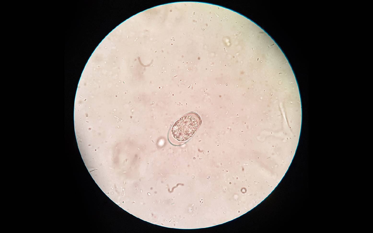 Coccidia Oocyst