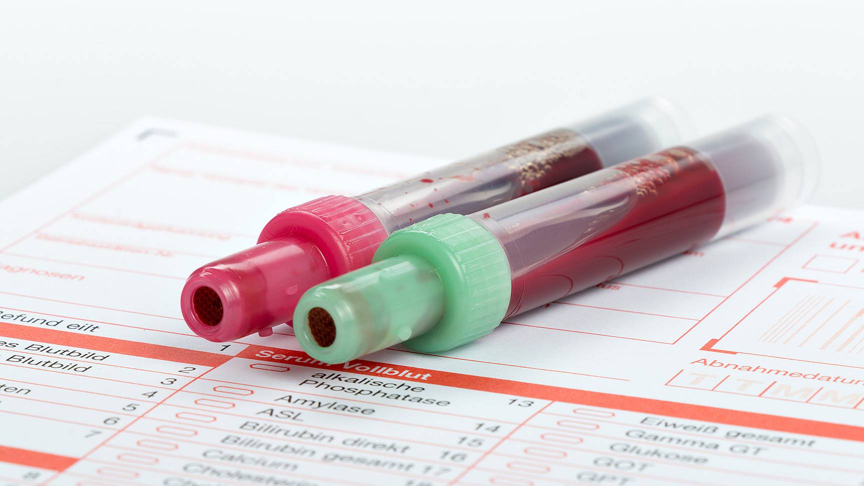 Two blood sample tubes on examination form