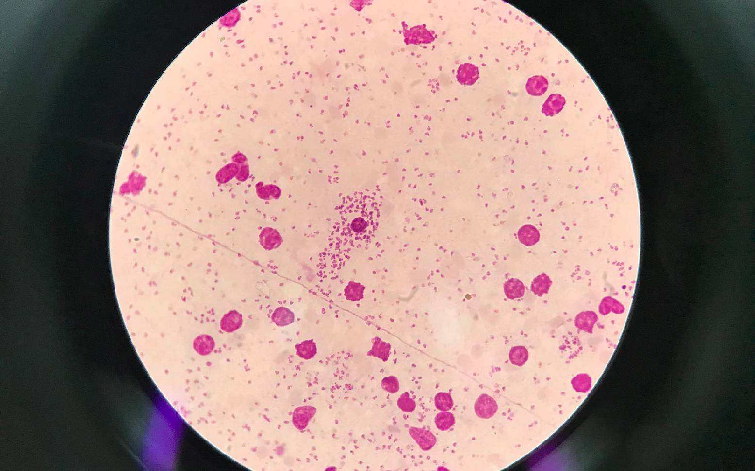 Leishmania under the microscope