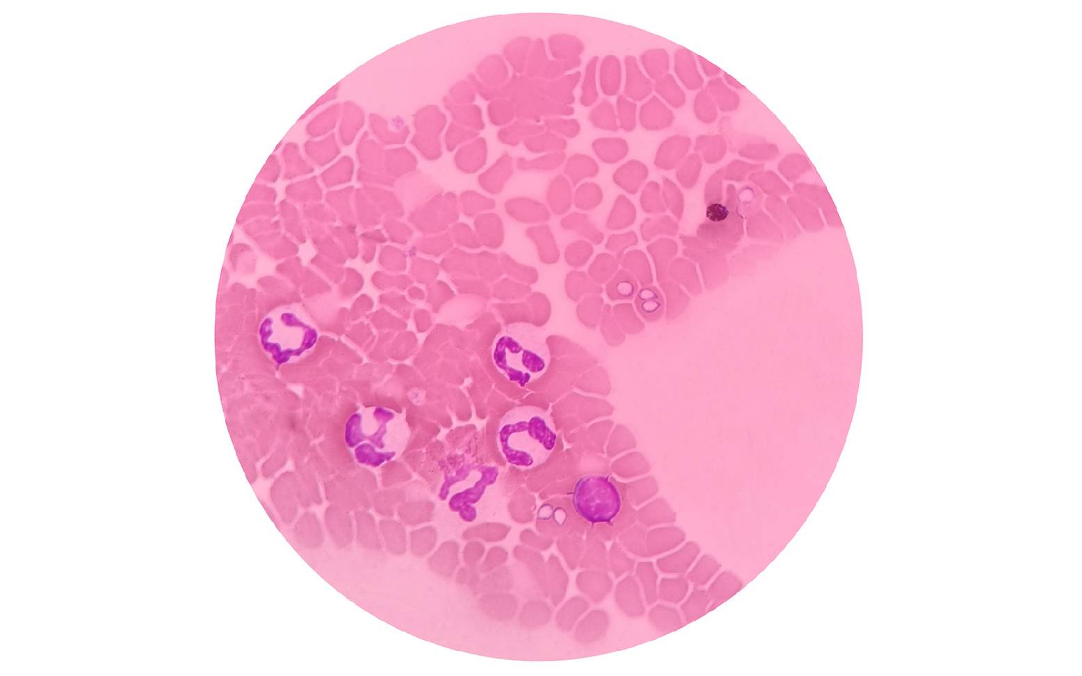 Babesia in blood smear