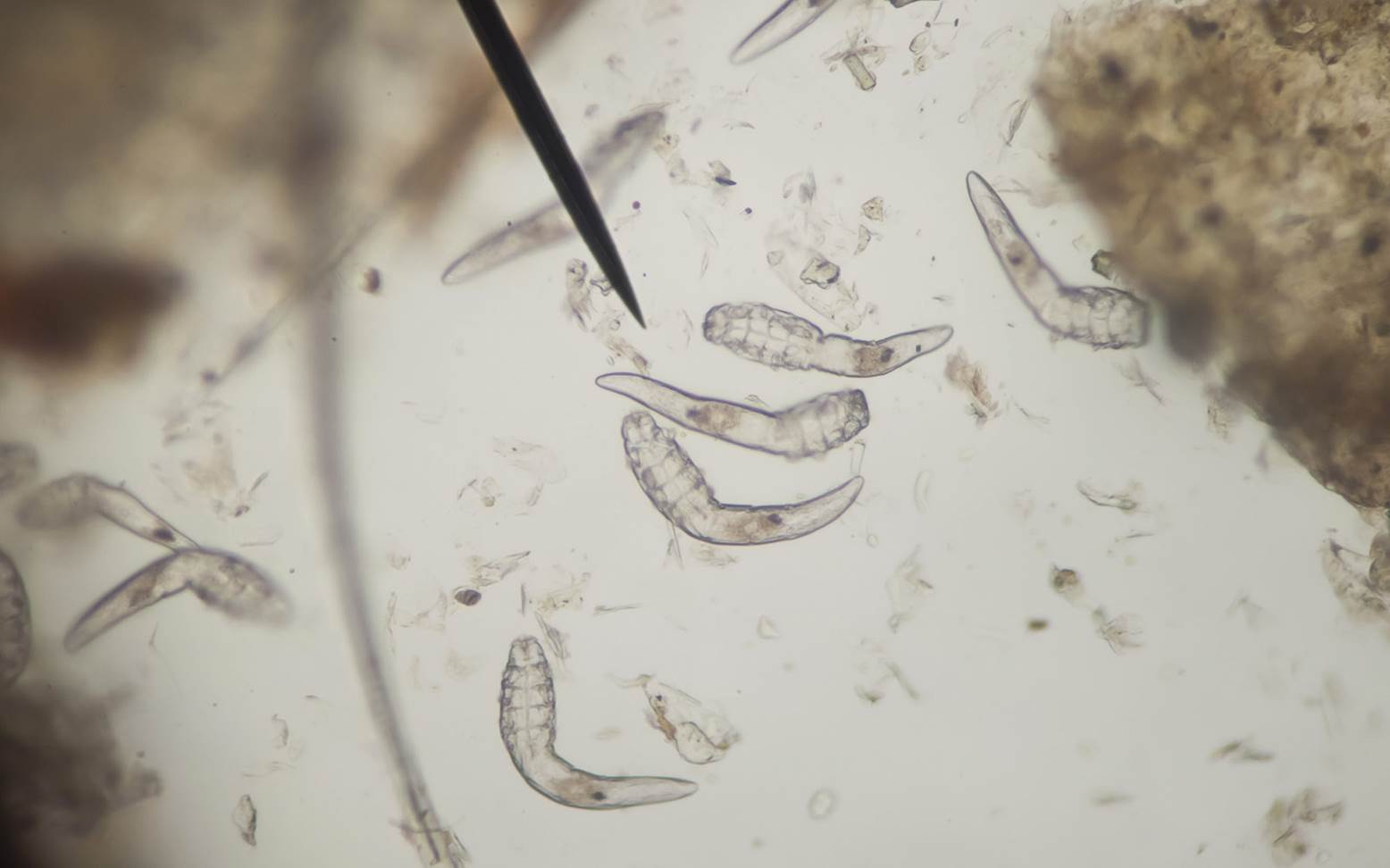 Demodex Milben im Mikroskop