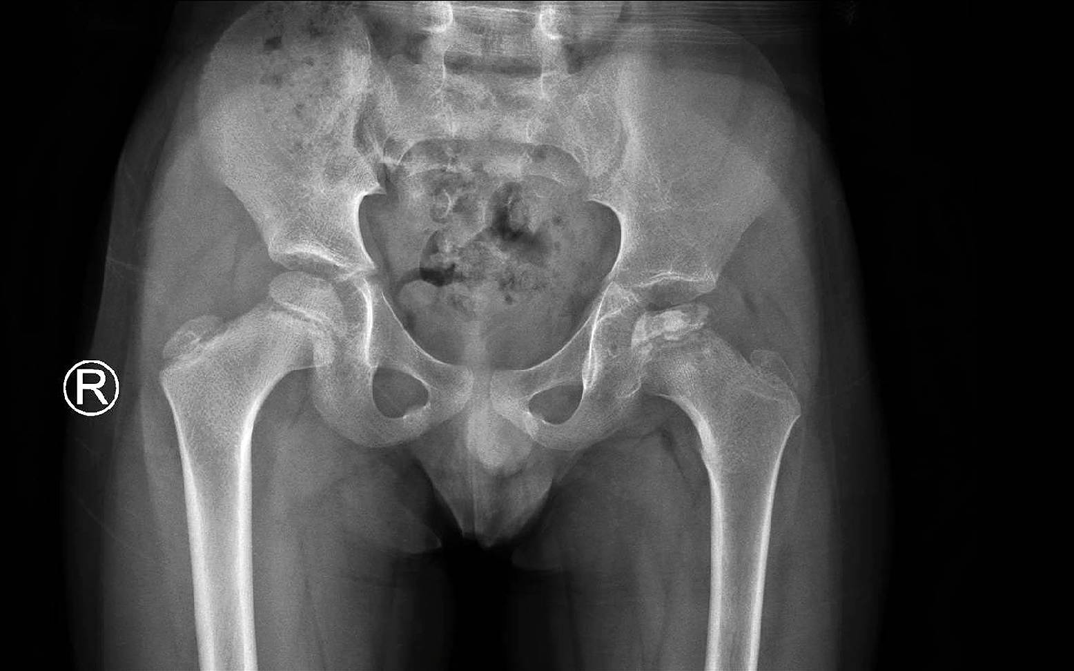 X-ray image of a dog's hip