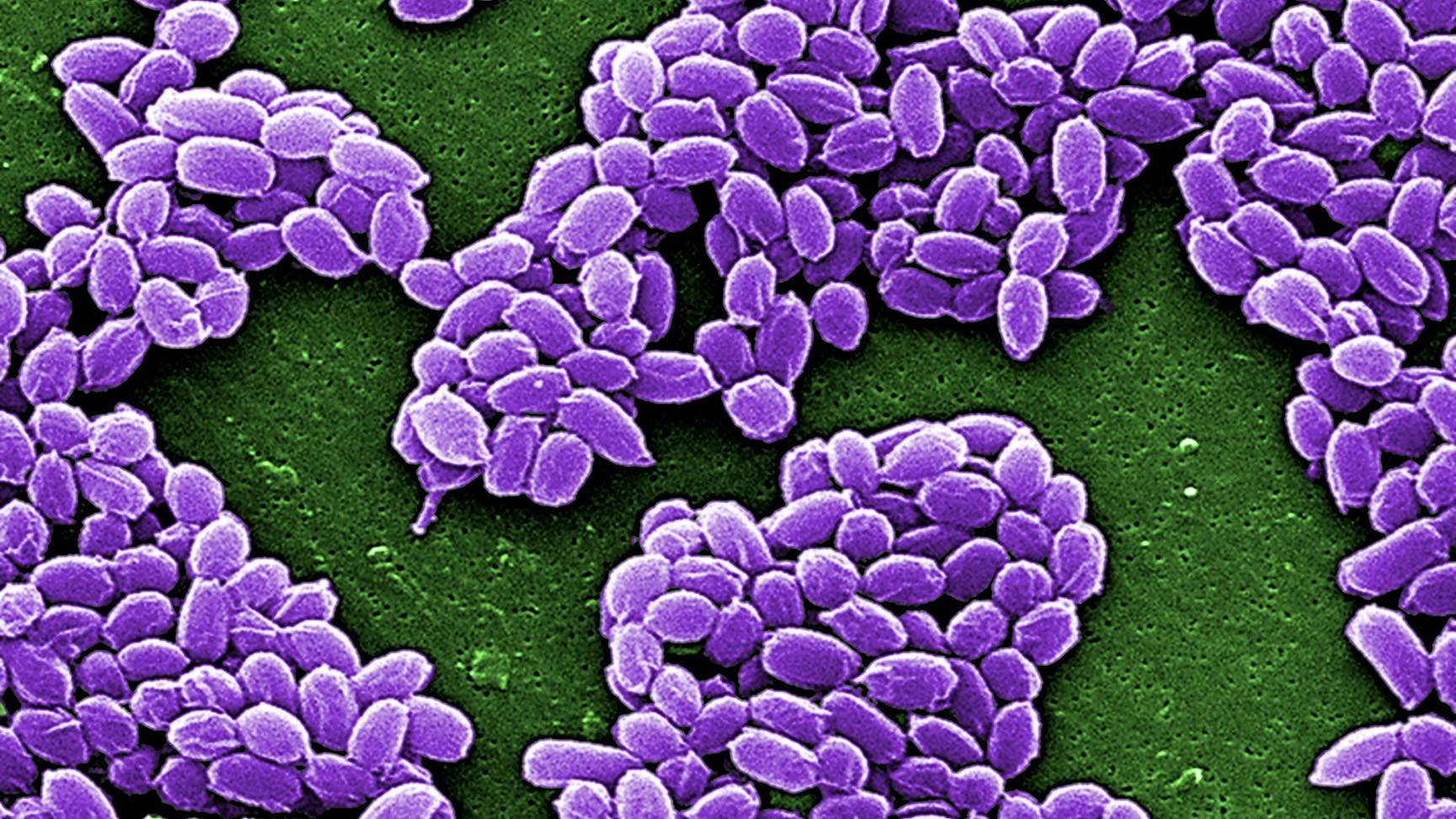 Electron micrograph of bacilli