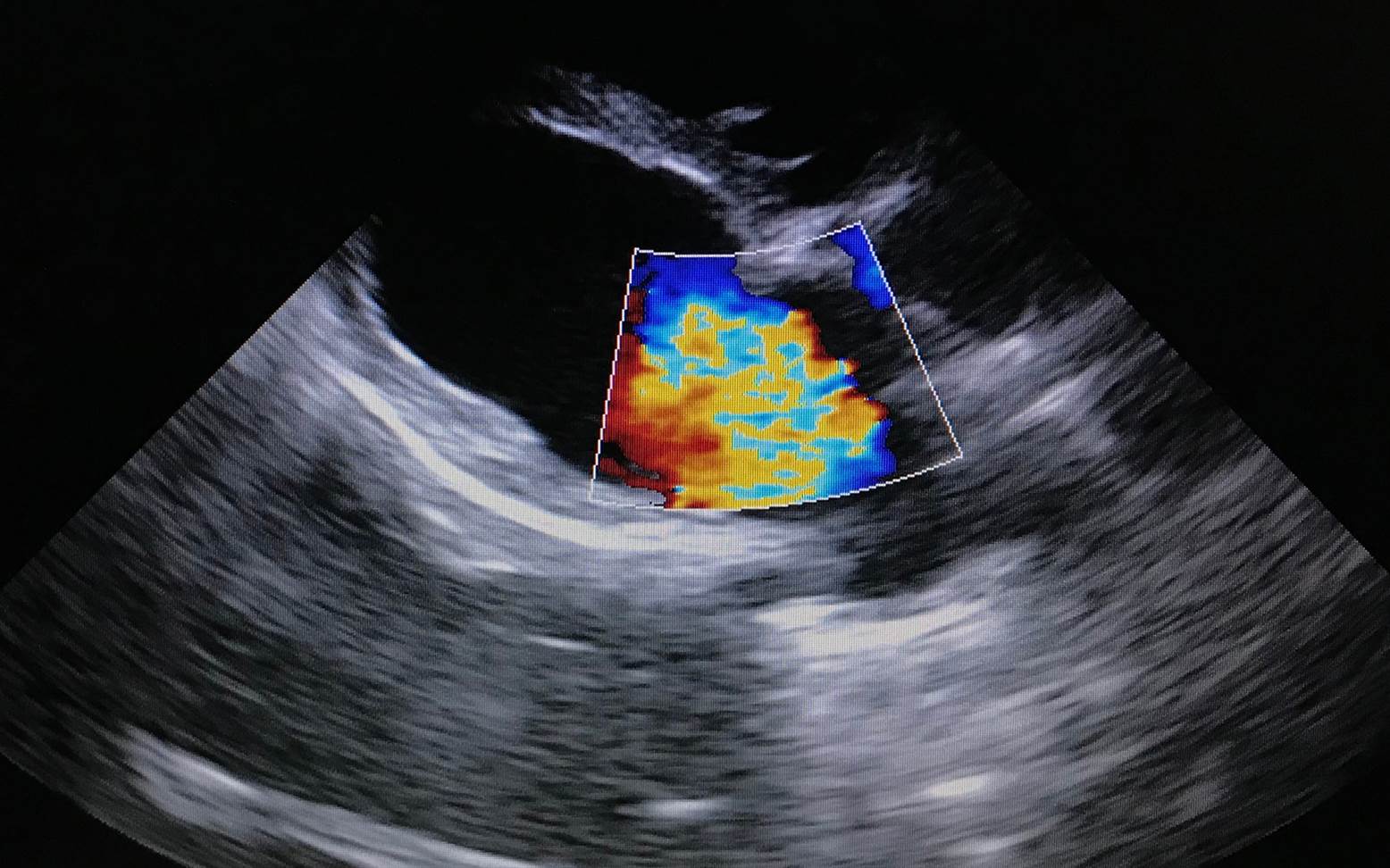 Heart ultrasound for dogs