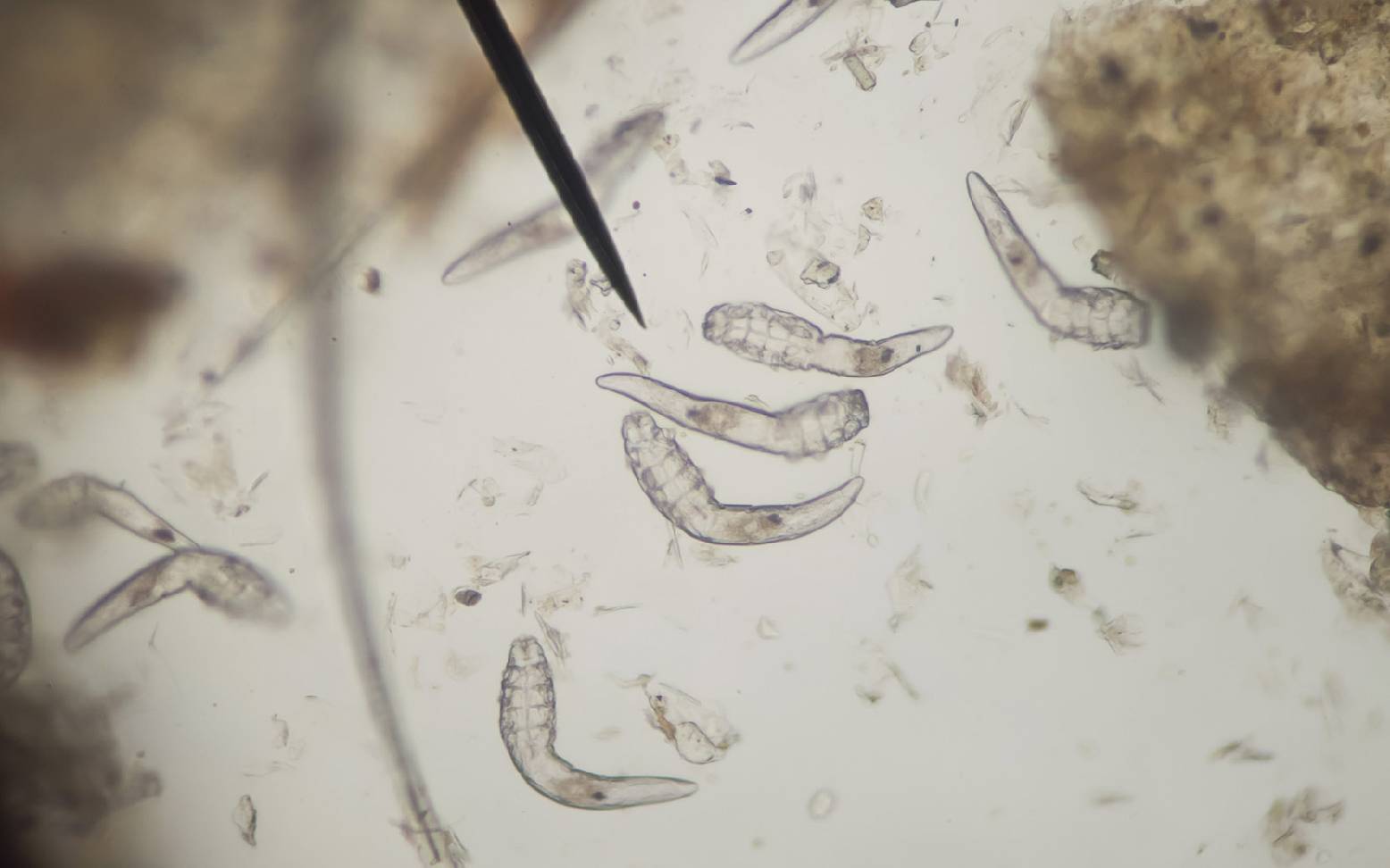 Demodex Milben im Mikroskop