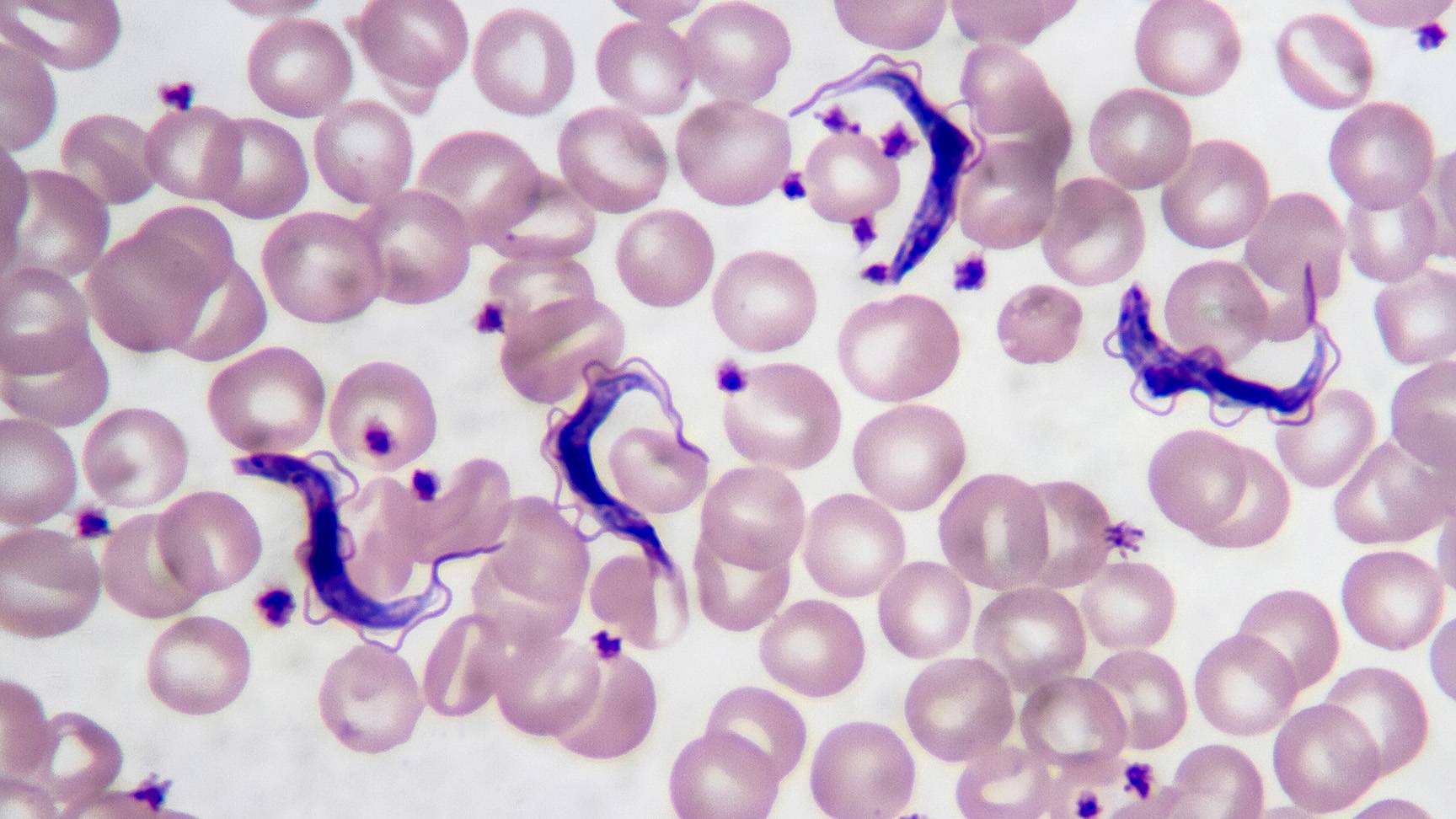 Trypanosomes in blood smear