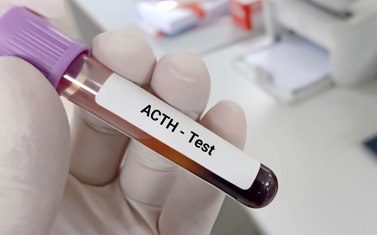 ACTH-Test