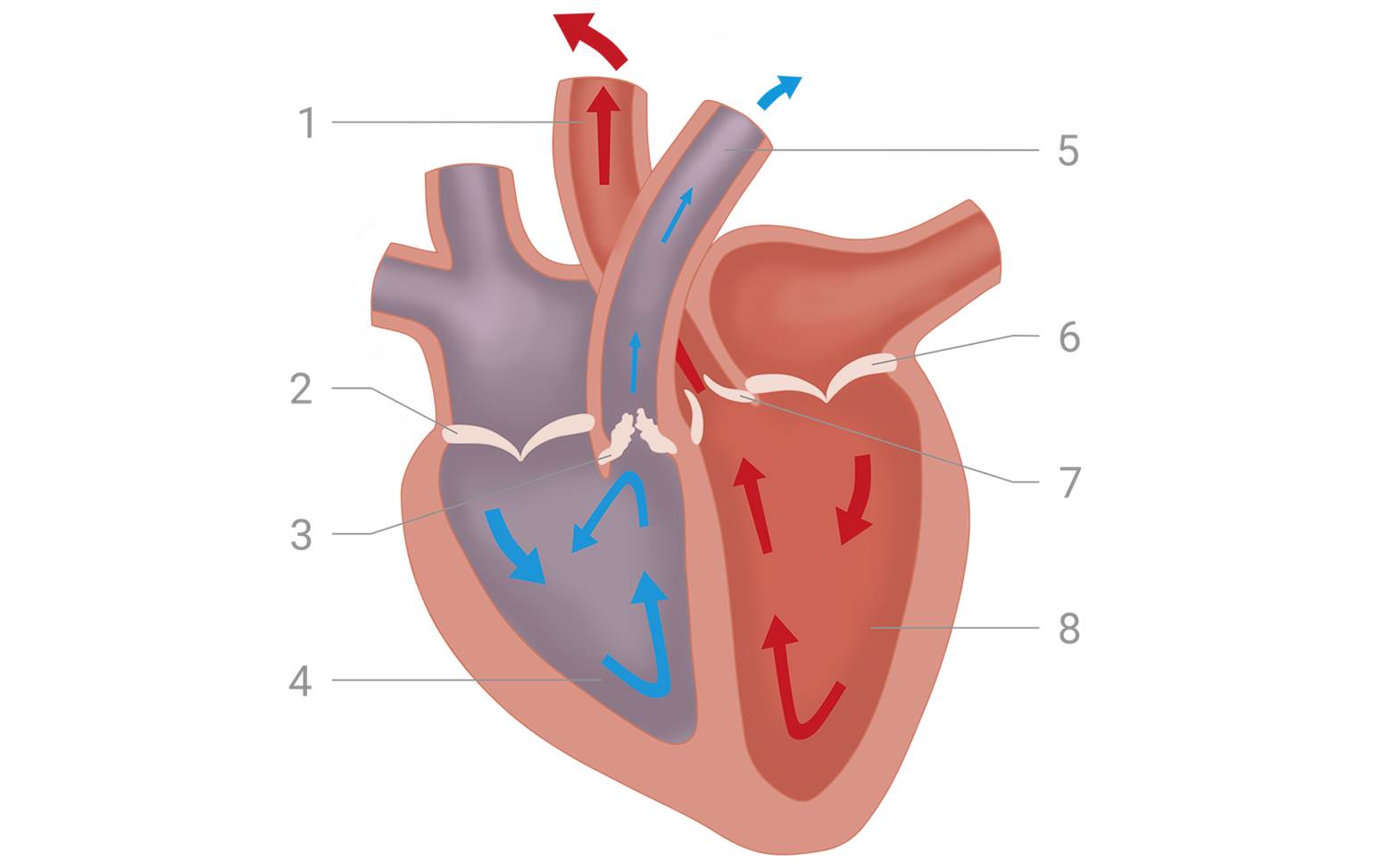 Schema Herz Pulmonalstenose