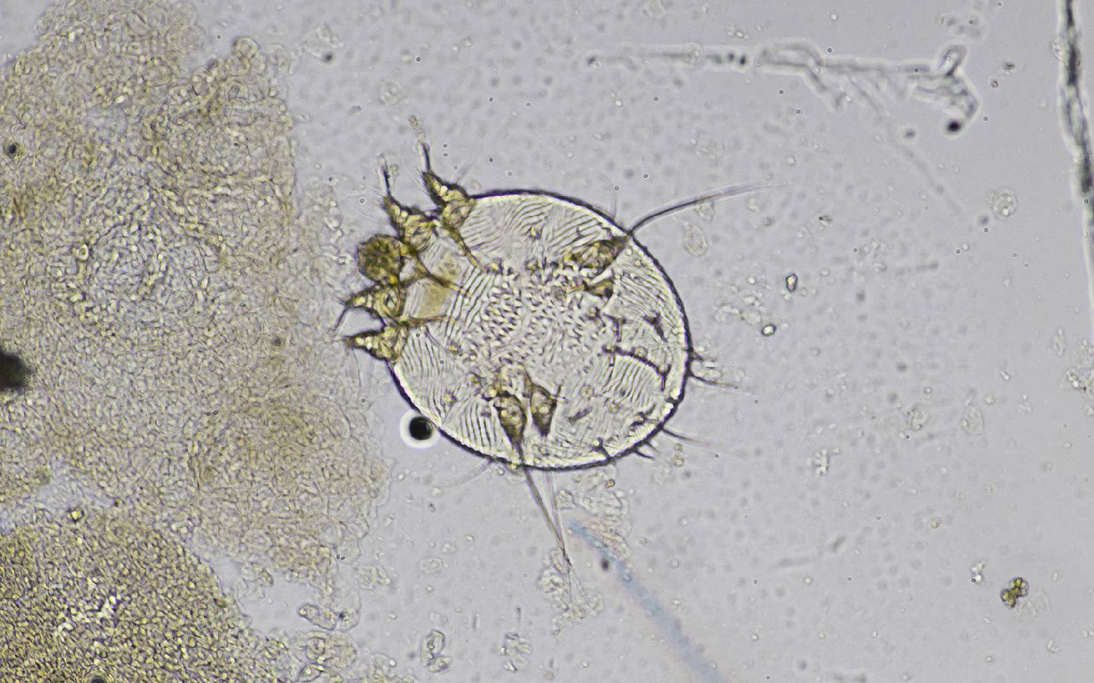 Sarcoptes mite 