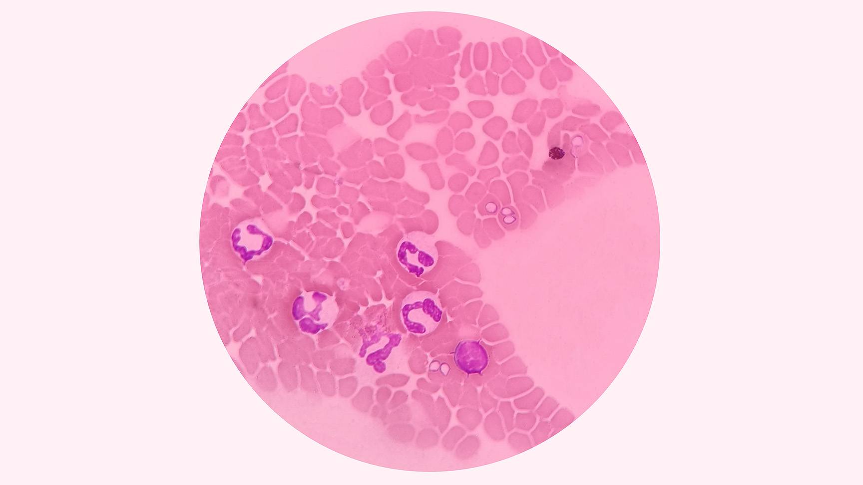 Babesia in blood smear