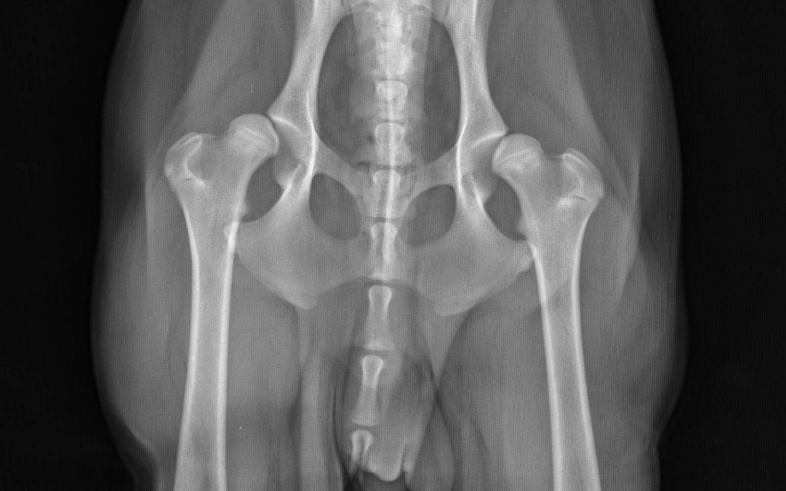 X-ray image of the hip
