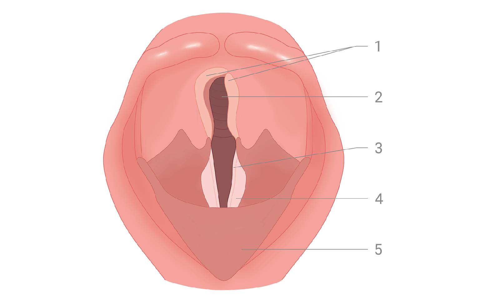 Diagram of the horse's larynx Pathological