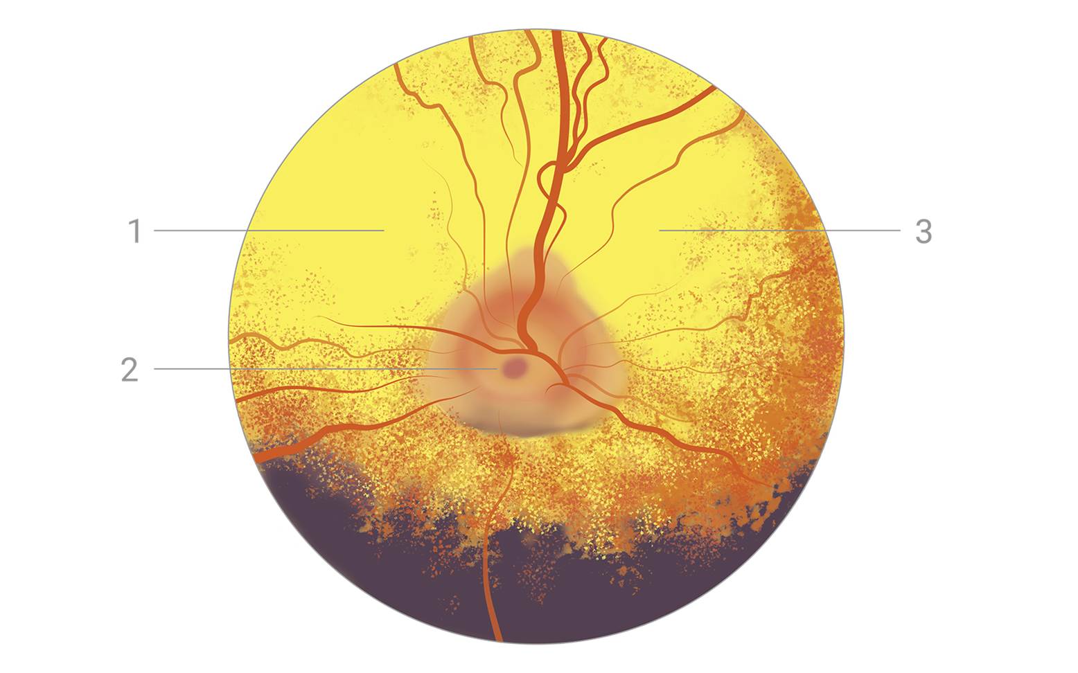 Eye fundus in dogs