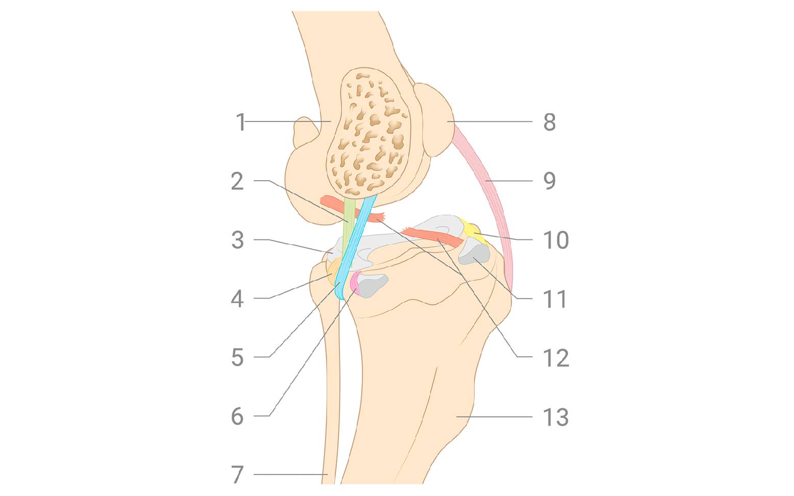 Schematic diagram of a cruciate ligament tear