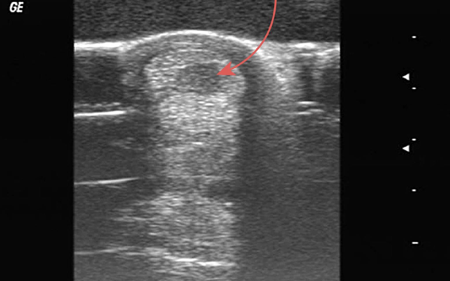 Ultraschall Sehne Pferd